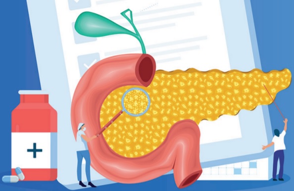 Ilustración de páncreas e intestino delgado